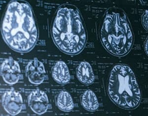 22 July. World Brain Day