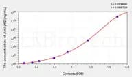 Human Anti-p62(Ubiquitin Binding Protein P62 Antibody) ELISA Kit