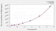 Human SSX2 (Protein SSX2) ELISA Kit