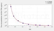 Human Anti-TTN(Anti-Titin Antibody) ELISA Kit