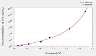 Human BPI(Bactericidal/Permeability Increasing Protein) ELISA Kit