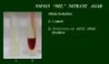 Nitrate Agar