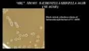 SS Agar (Salmonella Shigella Agar)
