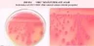 Deoxycholate Agar