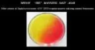 Mannitol Salt Agar (USP Basis)