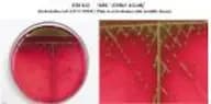 Endo Agar