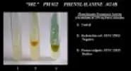 Phenylalanine Agar